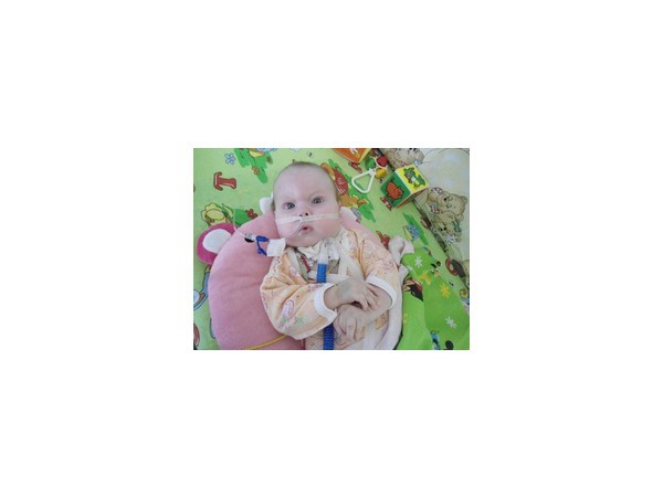 ИВЛ для того, чтобы жить дома