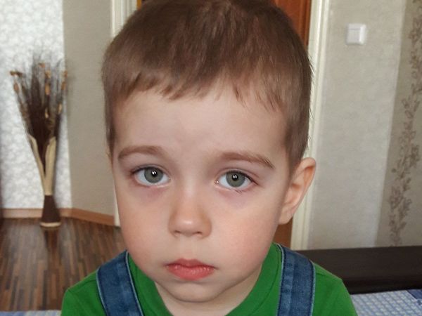 Жизнь Дениса зависит от помощи